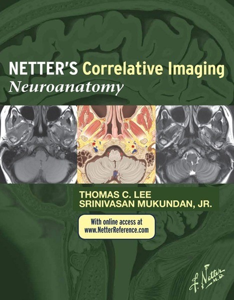 Netter's Correlative Imaging: Neuroanatomy main product photo