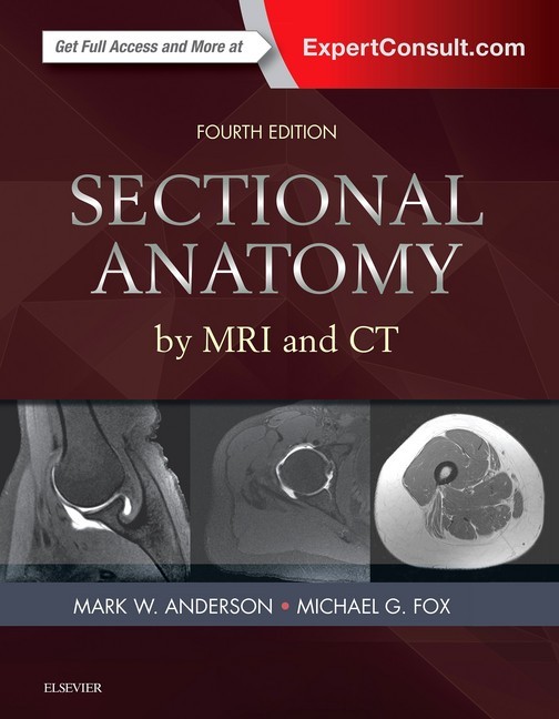 Sectional Anatomy by MRI and CT E-Book main product photo