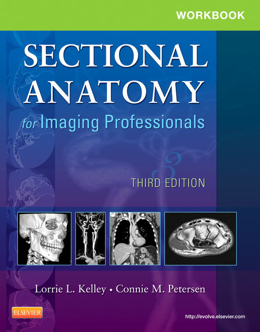 Workbook for Sectional Anatomy for Imaging Professionals - E-Book main product photo