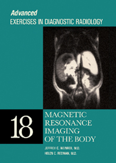 Magnetic Resonance Imaging of the Body main product photo
