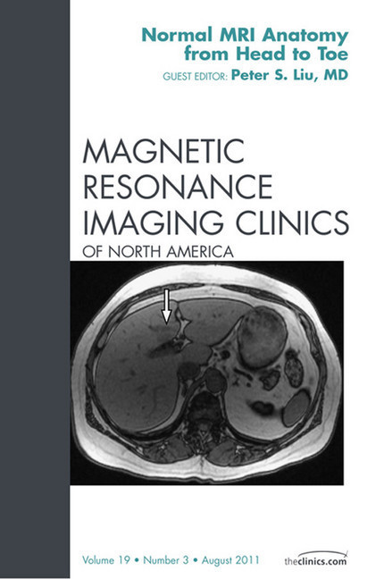 Normal MR Anatomy, An Issue of Magnetic Resonance Imaging Clinics main product photo