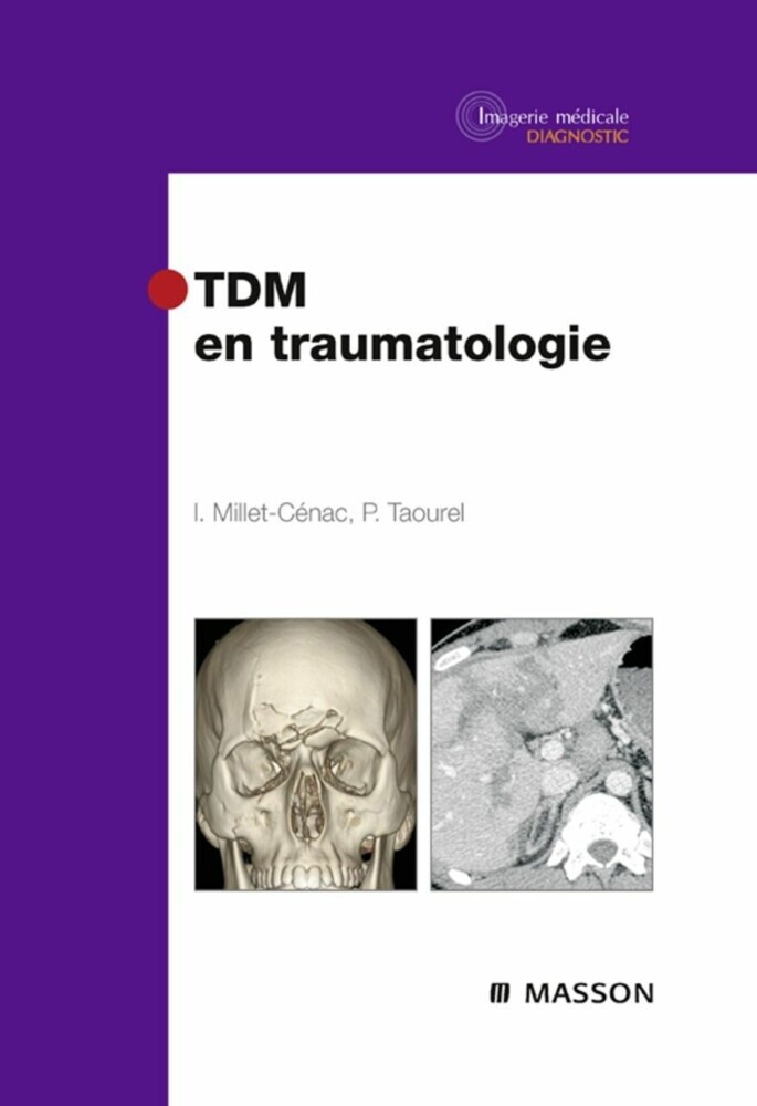 TDM en traumatologie CAMPUS main product photo