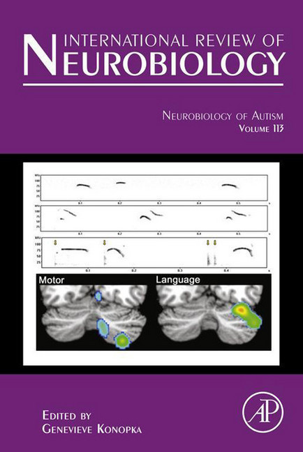 Neurobiology of Autism main product photo