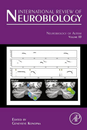 Neurobiology of Autism
