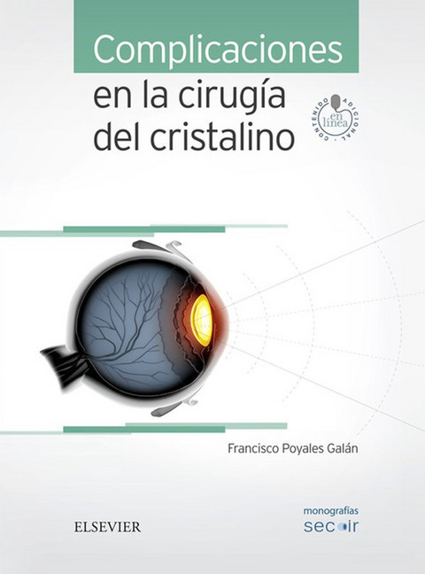 Complicaciones en la cirugía del cristalino main product photo