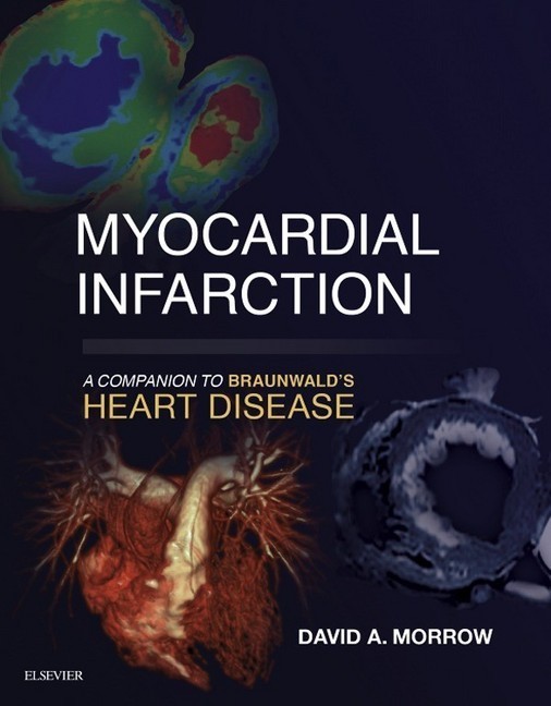 Myocardial Infarction: A Companion to Braunwald's Heart Disease main product photo