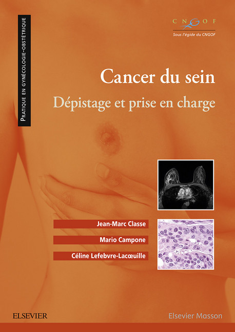 Cancer du sein main product photo