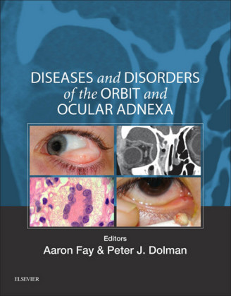 Diseases and Disorders of the Orbit and Ocular Adnexa