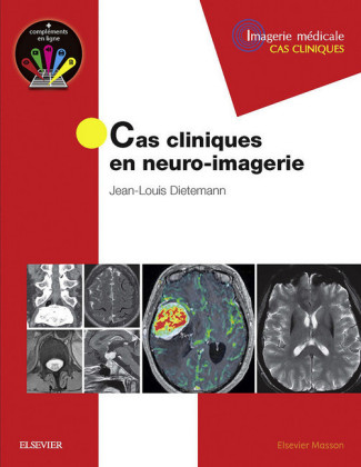 Cas cliniques en  neuro-imagerie