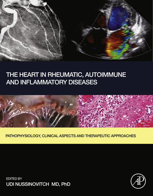 The Heart in Rheumatic, Autoimmune and Inflammatory Diseases main product photo