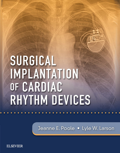 Surgical Implantation of Cardiac Rhythm Devices main product photo