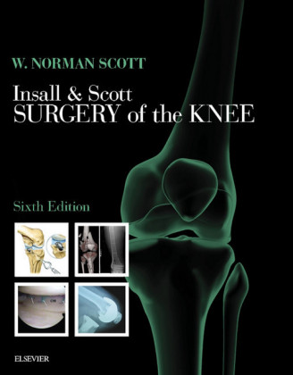 Insall & Scott Surgery of the Knee