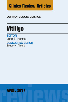 Vitiligo, An Issue of Dermatologic Clinics,
