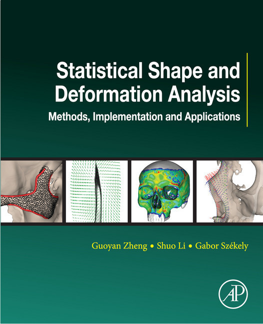 Statistical Shape and Deformation Analysis main product photo