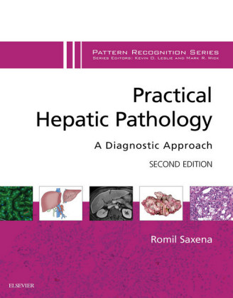Practical Hepatic Pathology: A Diagnostic Approach E-Book