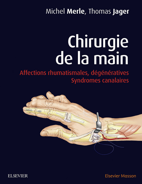Chirurgie de la main main product photo