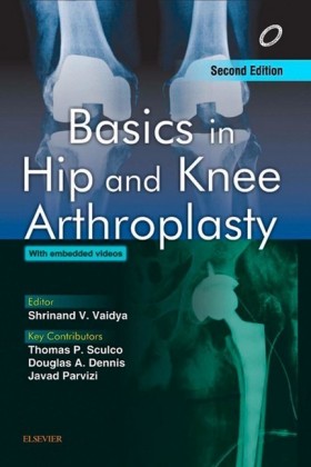 Basics in Hip and Knee Arthroplasty - E-book