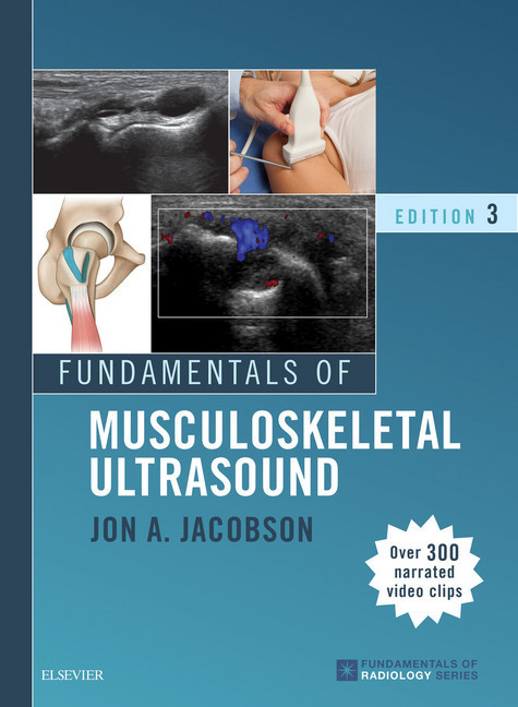 Fundamentals of Musculoskeletal Ultrasound E-Book main product photo