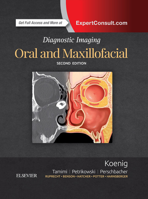 Diagnostic Imaging: Oral and Maxillofacial E-Book main product photo