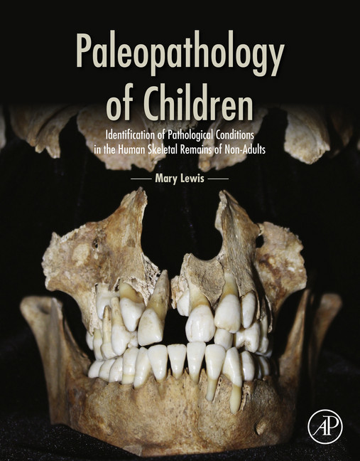 Paleopathology of Children main product photo