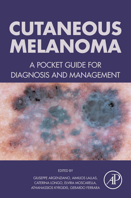 Cutaneous Melanoma main product photo