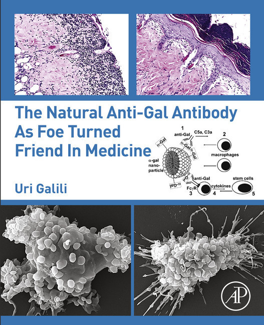 The Natural Anti-Gal Antibody as Foe Turned Friend in Medicine main product photo