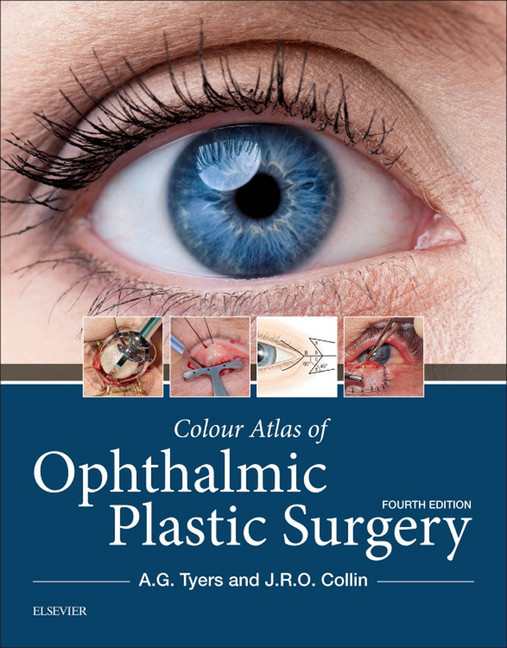 Colour Atlas of Ophthalmic Plastic Surgery E-Book main product photo