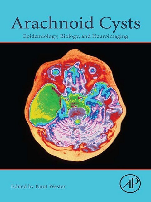 Arachnoid Cysts main product photo