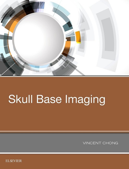 Skull Base Imaging main product photo