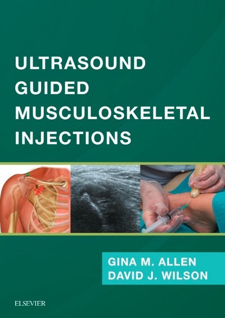 Ultrasound Guided Musculoskeletal Injections E-Book main product photo