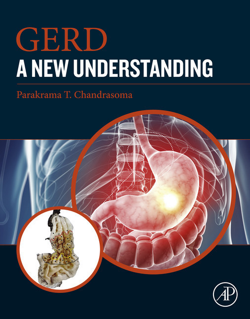 GERD main product photo