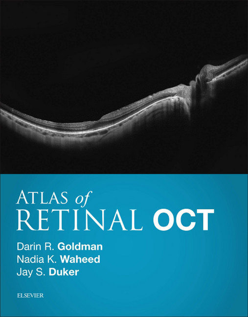 Atlas of Retinal OCT E-Book main product photo