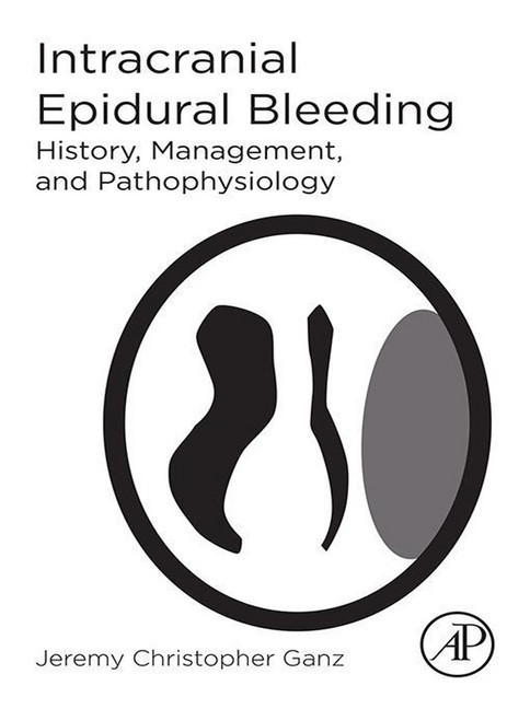 Intracranial Epidural Bleeding main product photo
