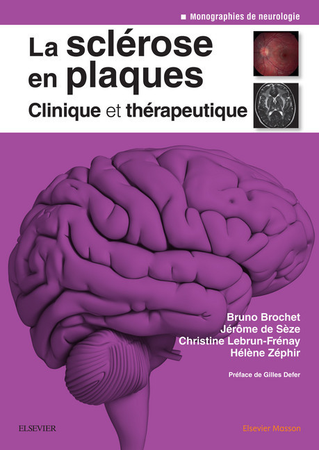 La sclérose en plaques - Clinique et thérapeutique main product photo