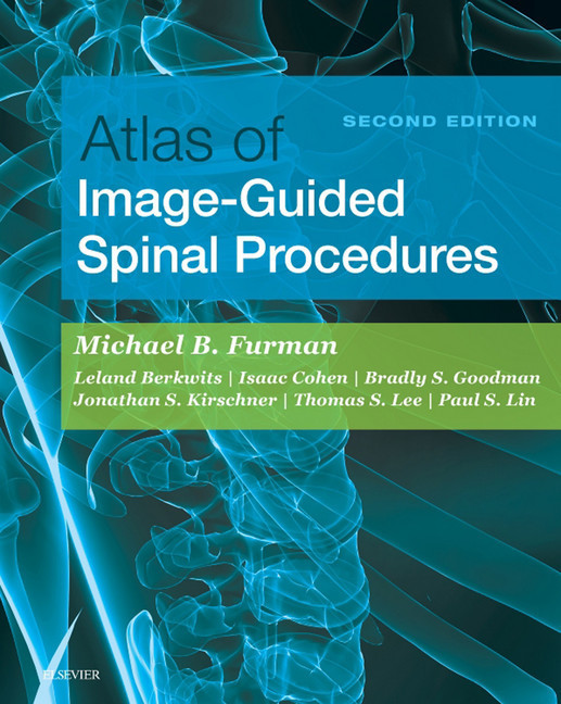 Atlas of Image-Guided Spinal Procedures E-Book main product photo