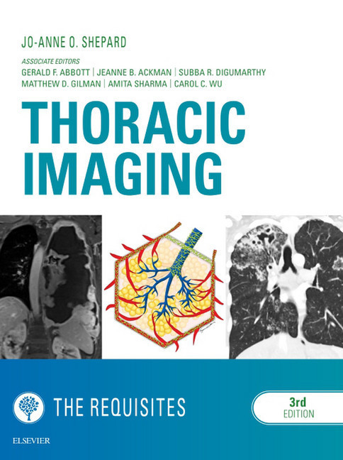 Thoracic Imaging The Requisites E-Book main product photo