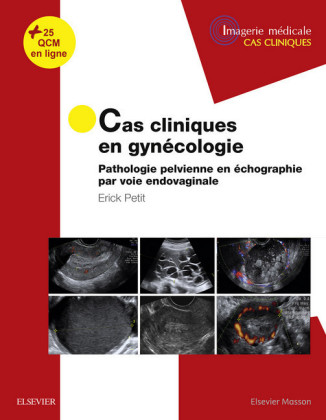 Cas cliniques en imagerie : gynécologie
