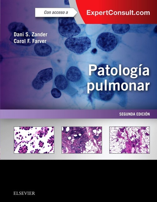 Patología pulmonar + ExpertConsult main product photo