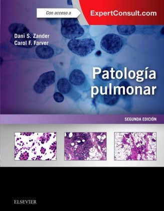 Patología pulmonar + ExpertConsult