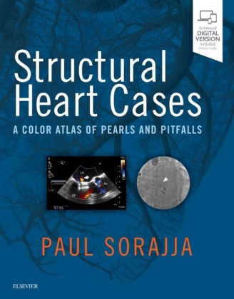 Structural Heart Cases E-Book