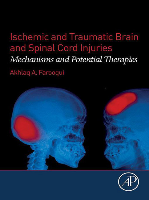 Ischemic and Traumatic Brain and Spinal Cord Injuries main product photo