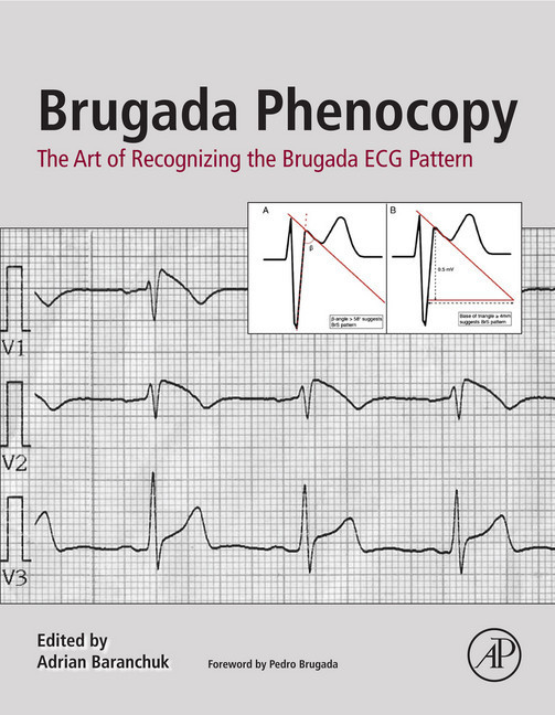 Brugada Phenocopy main product photo