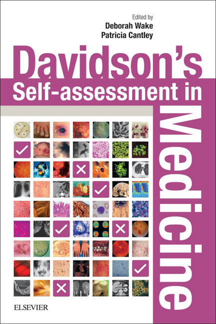 Davidson's Self-assessment in Medicine E-Book main product photo