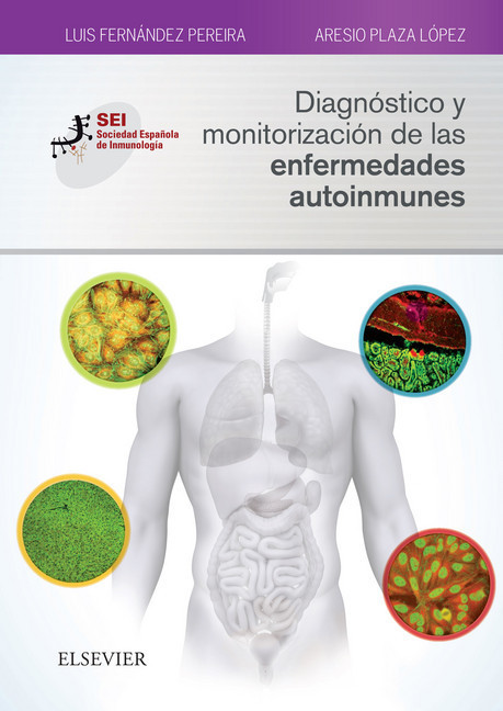 Diagnóstico y monitorización de las enfermedades autoinmunes main product photo