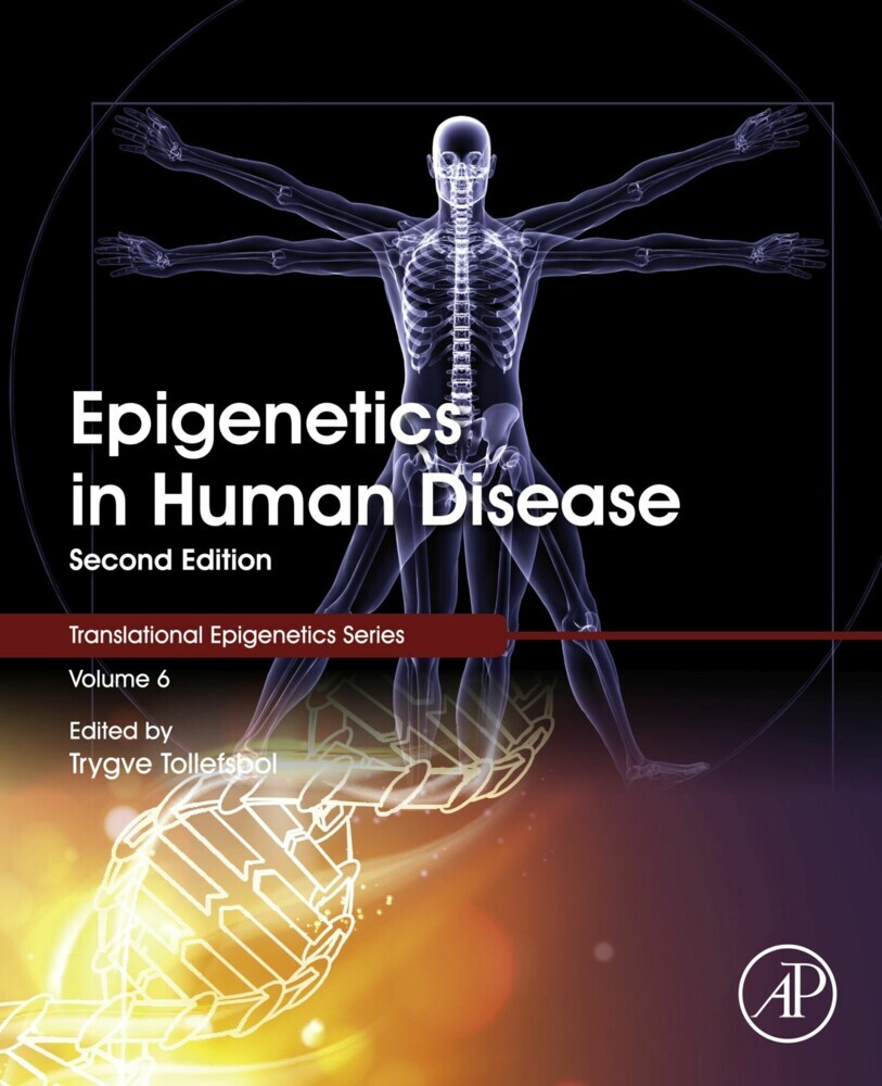 Epigenetics in Human Disease main product photo