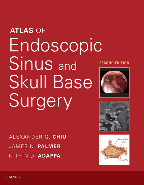 Atlas of Endoscopic Sinus and Skull Base Surgery E-Book main product photo
