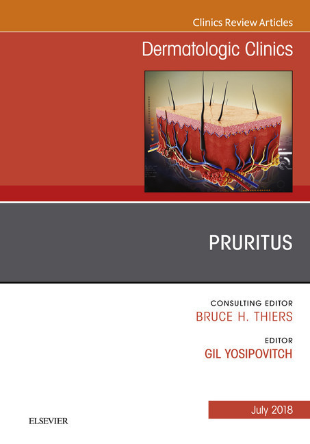 Pruritus, An Issue of Dermatologic Clinics, E-Book main product photo
