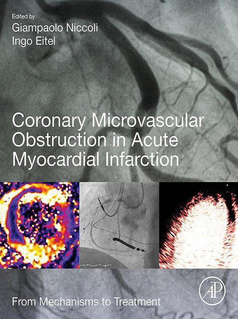 Coronary Microvascular Obstruction in Acute Myocardial Infarction main product photo