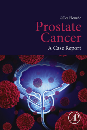 Prostate Cancer