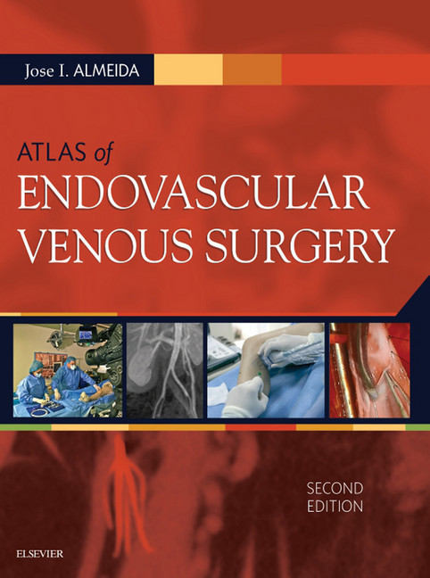 Atlas of Endovascular Venous Surgery E-Book main product photo